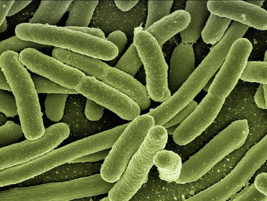 Bakteria coli w wodociągu pod Oleśnicą