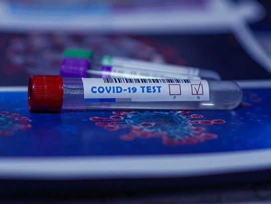 Członkowie Zarządu Powiatu Oleśnickiego poznali wyniki testów na COVID-19