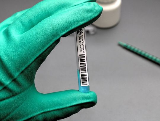 Nie ma miejsc na szczepienia do końca marca
