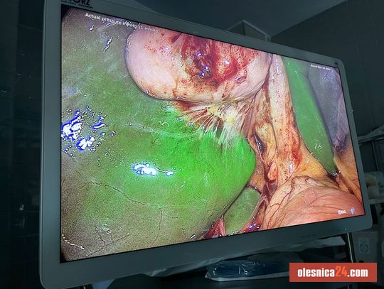 Nowoczesna technologia na bloku operacyjnym w Oleśnicy