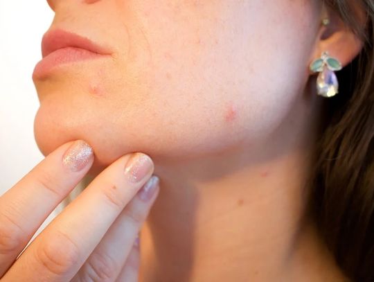 Sytuacja epidemiologiczna wybranych chorób zakaźnych  w Oleśnicy i powiecie oleśnickim w 2021 roku