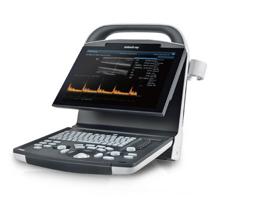 Ultrasonografy – sprzęt medyczny do badań diagnostycznych