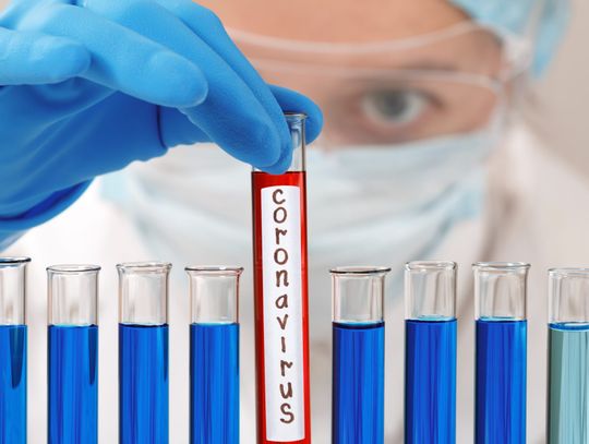 UWAGA, aktualna sytuacja epidemicza - stan na 5 kwietnia, godz. 10