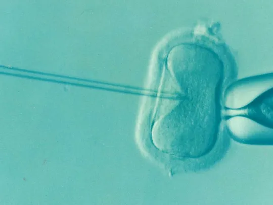 W Oleśnicy 7 000 zł dofinansowania do in vitro