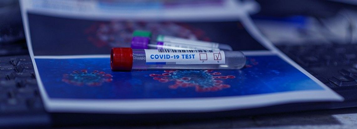 Członkowie Zarządu Powiatu Oleśnickiego poznali wyniki testów na COVID-19