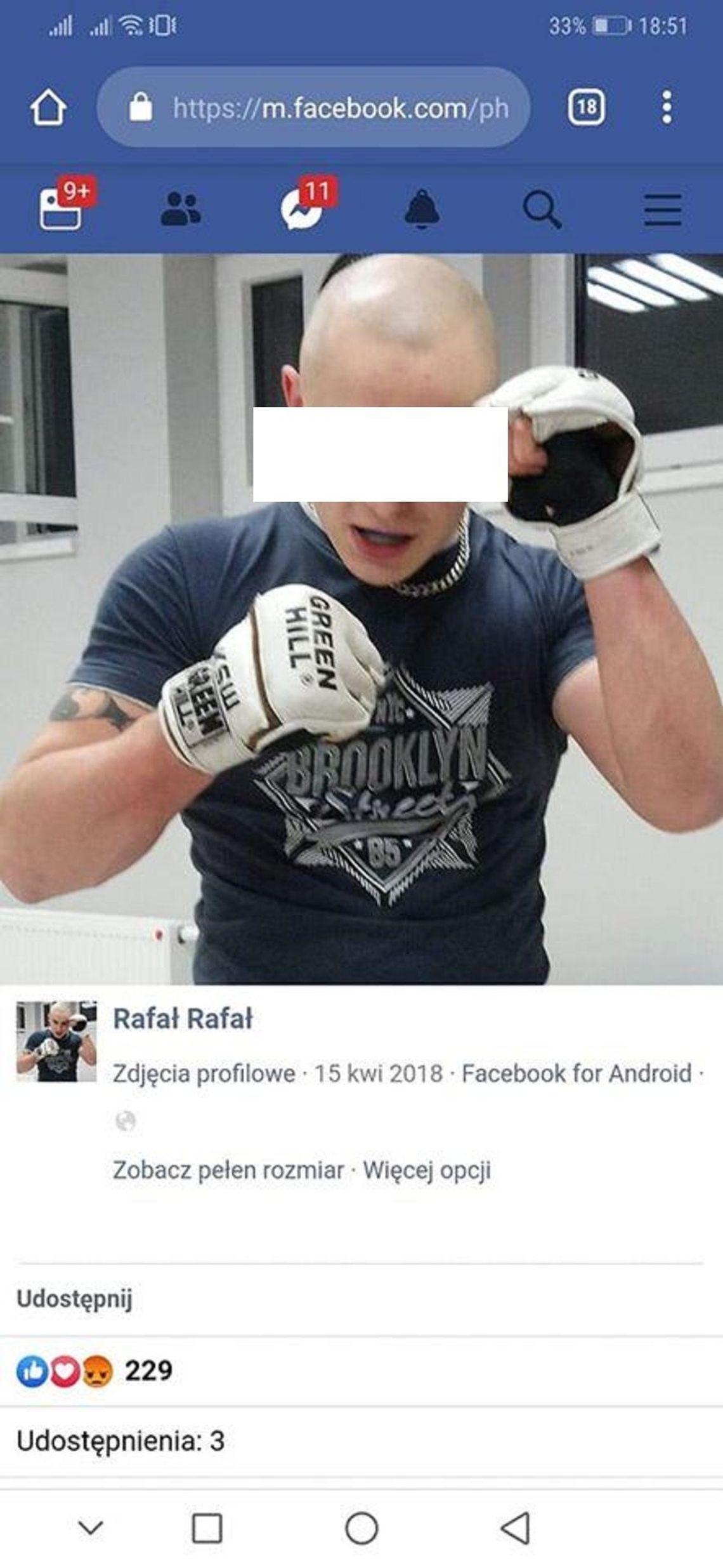 Ludzie nawołują do samosądu - potrzebna będzie ochrona domu sprawcy zabicia psa?