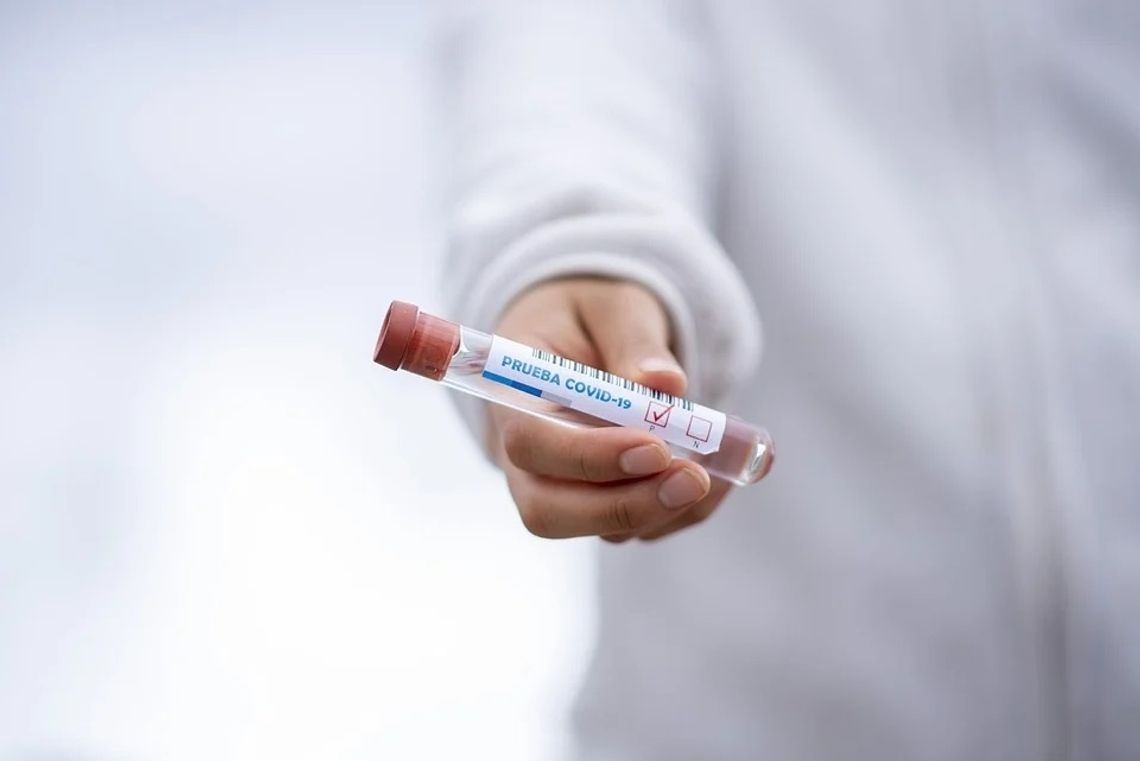 NASZ NEWS: Apteka w Oleśnicy rozpoczęła testy na obecność koronawirusa