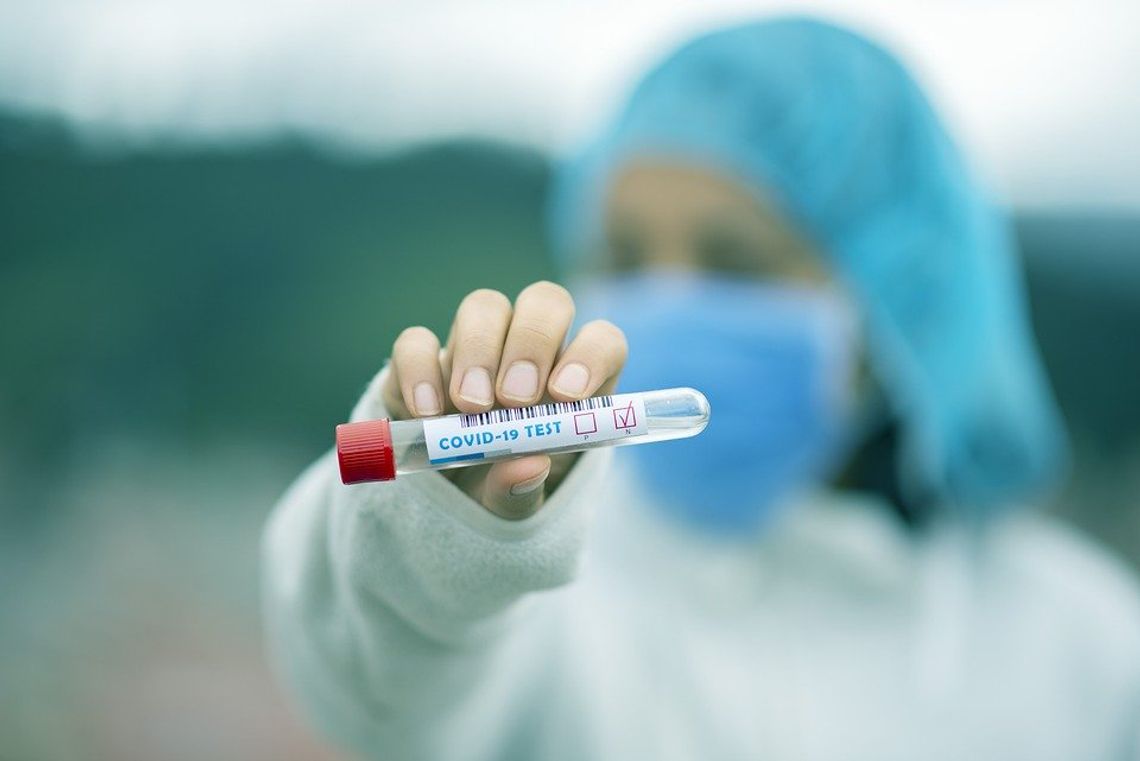 Wojewoda i miasto sfinasują ok. 60 testów dla oleśniczan